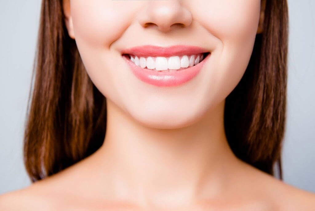 professional teeth whitening Indianapolis Indiana