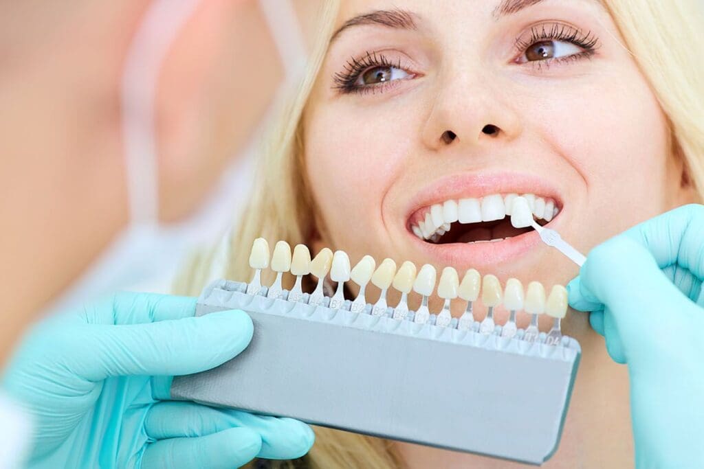 Will Porcelain Veneers Look Natural